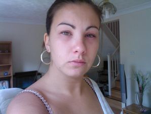 Pierced green-eye. Part 4. Thumb 20