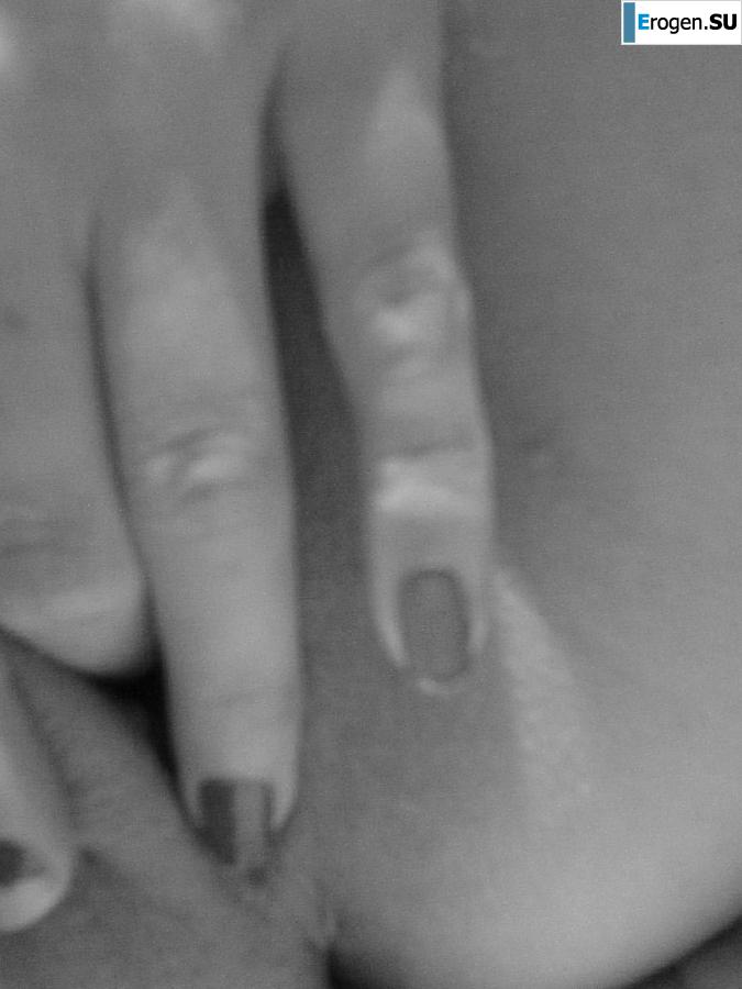 self-inspection after a shower. Photo 10